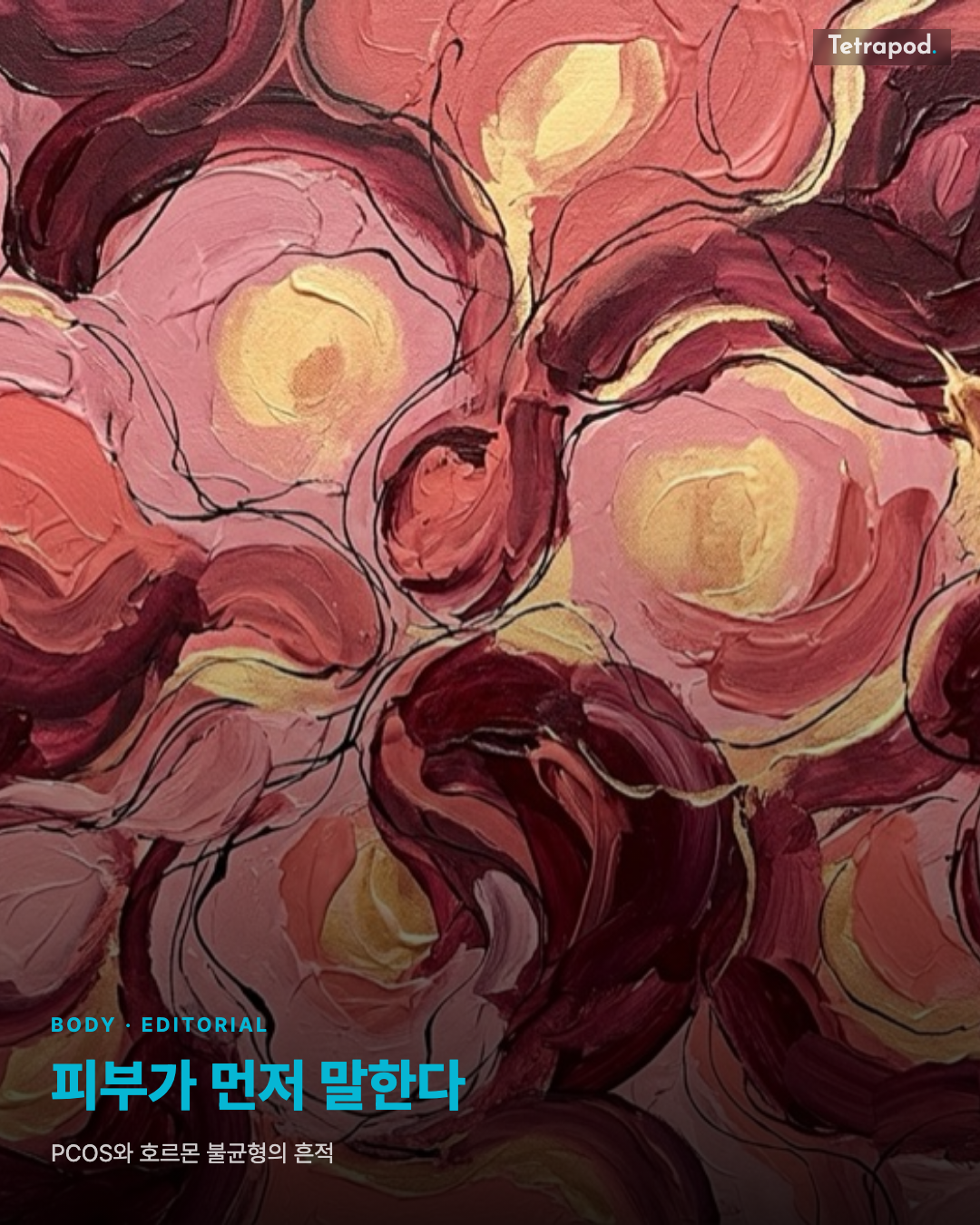 피부가 먼저 말한다, PCOS의 호르몬 신호