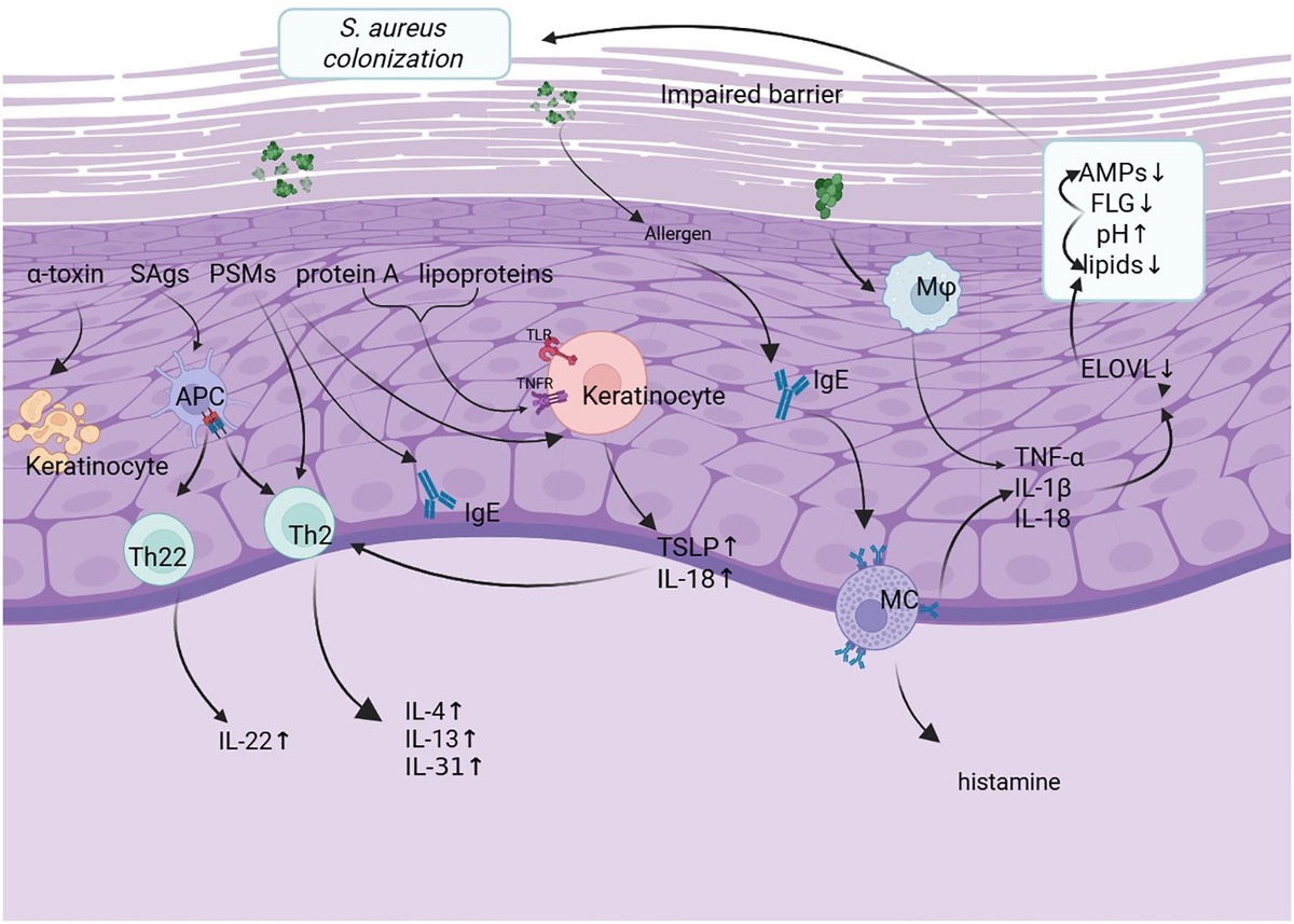 아토피 피부염, 피부가 아니라 장에서 시작될 수 있다