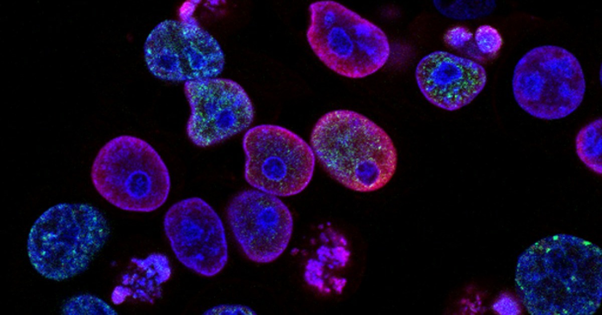 에크토인, 아토피 4주 만에 SCORAD 42에서 15로